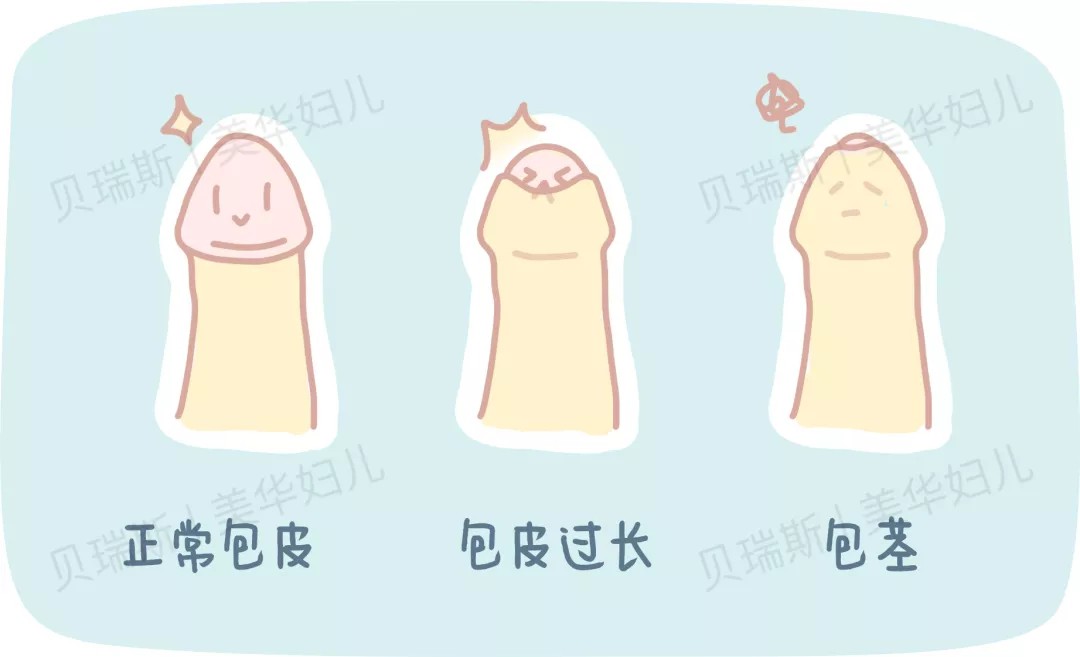 母婴知识 家有男宝 小丁丁 的这几件事越早知道越好 最新消息 杭州美华妇儿医院 官网 杭州妇产科医院 杭州高端妇产医院 杭州高端儿科医院 省妇 儿保专家 定期坐诊 母婴知识 家有男宝 小丁丁 的这几件事越早知道越好 最新消息 杭州美华妇儿医院 官网 杭州妇产科医院 杭州高端妇产医院 杭州高端儿科医院 省妇 儿保专家 定期坐诊